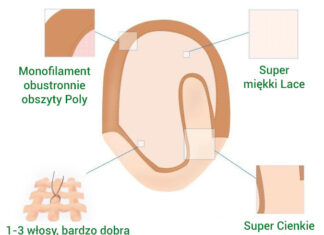 Czy przeszczep włosów jest koniecznością? łysienie