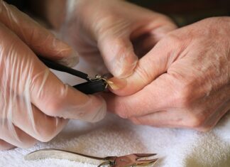 Jak obciąć wrastające paznokcie? Jak obciąć wrastające paznokcie?