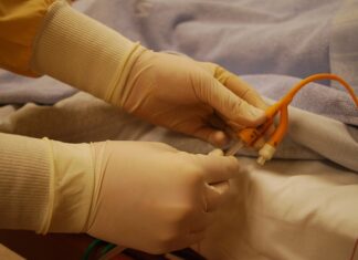 Co ile wymienia się cewnik silikonowy? Co ile wymienia się cewnik silikonowy?